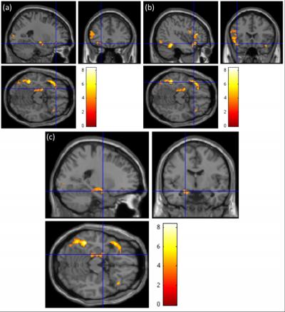 Brain Scans