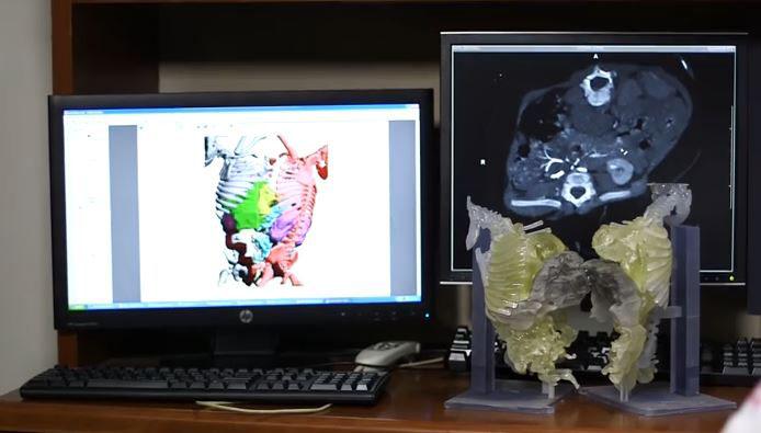3-D Color Segmentation 
