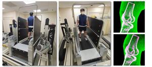 Prof. Seungbum Koo’s Team Receives Clinical Biomechanics Award at the 30th International Society of Biomechanics Conference​