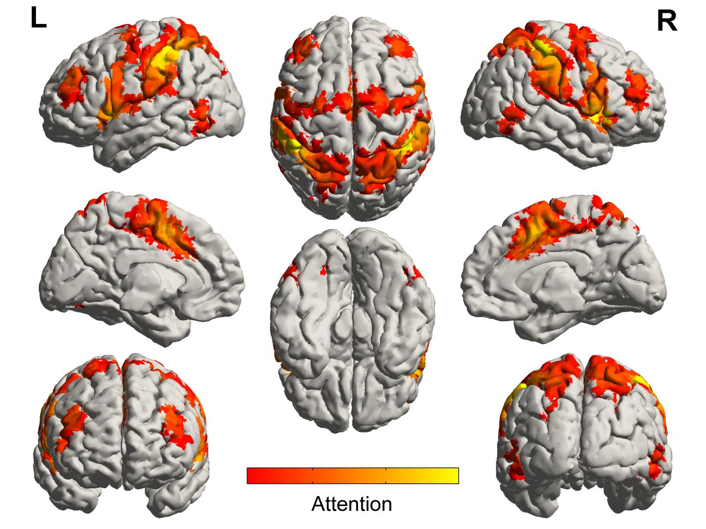 Brain Networks Involved in Processing Attention