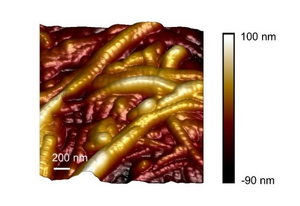 Collagen fibres