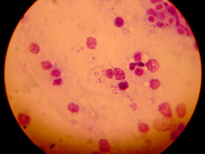 Leishmania Impression Smear