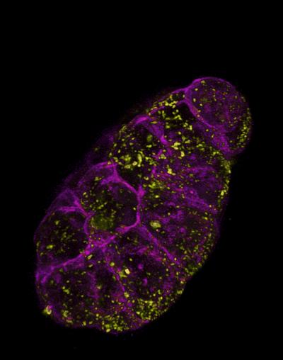 Under the Microscope, Shape-Shifting Cells (1 of 5)