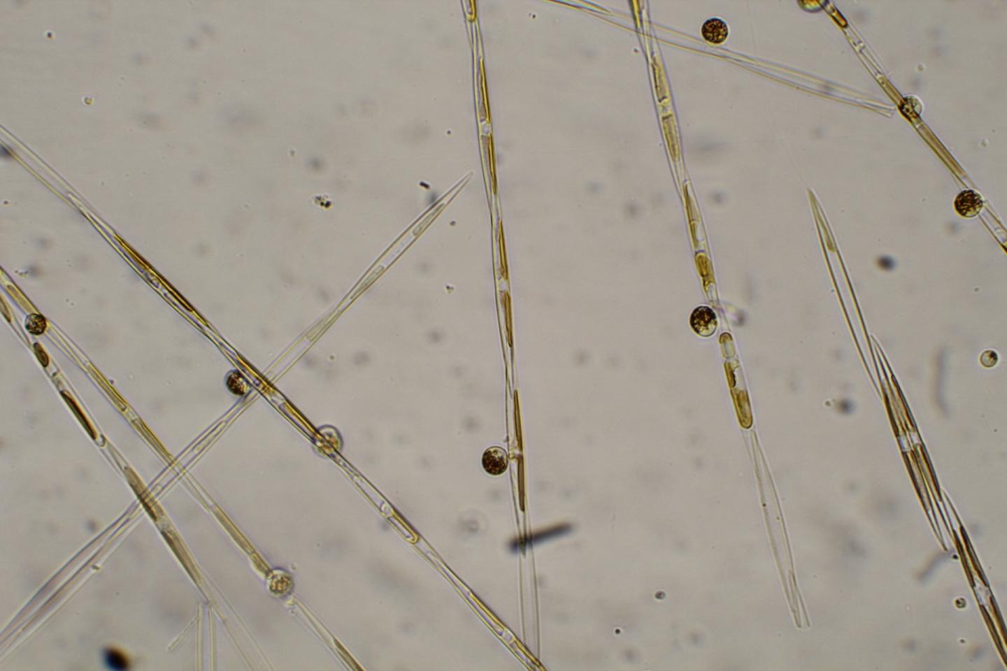 Pseudo-Nitzschia, the Source of Domoic Acid