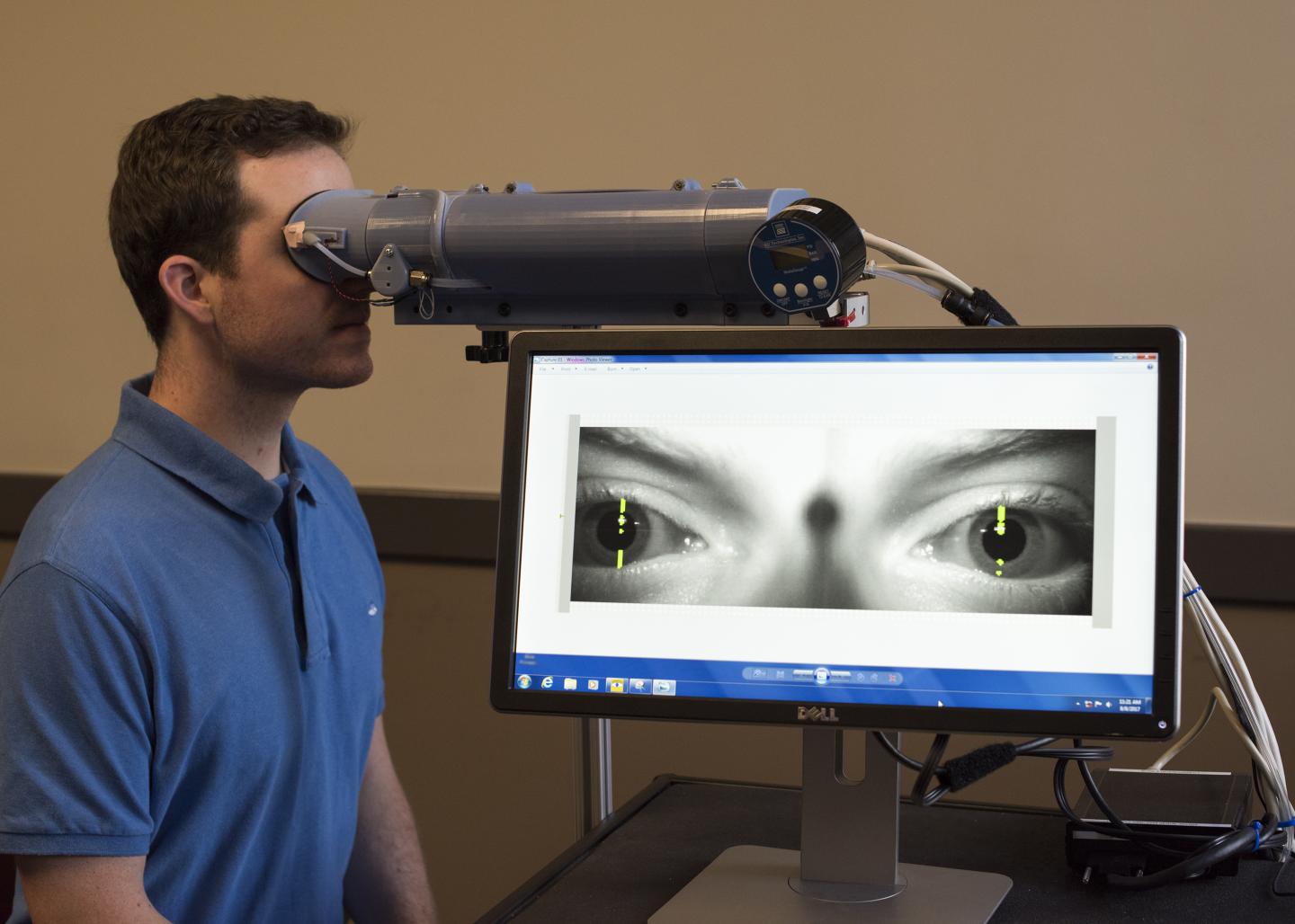 Prototype of Blink Reflexometer