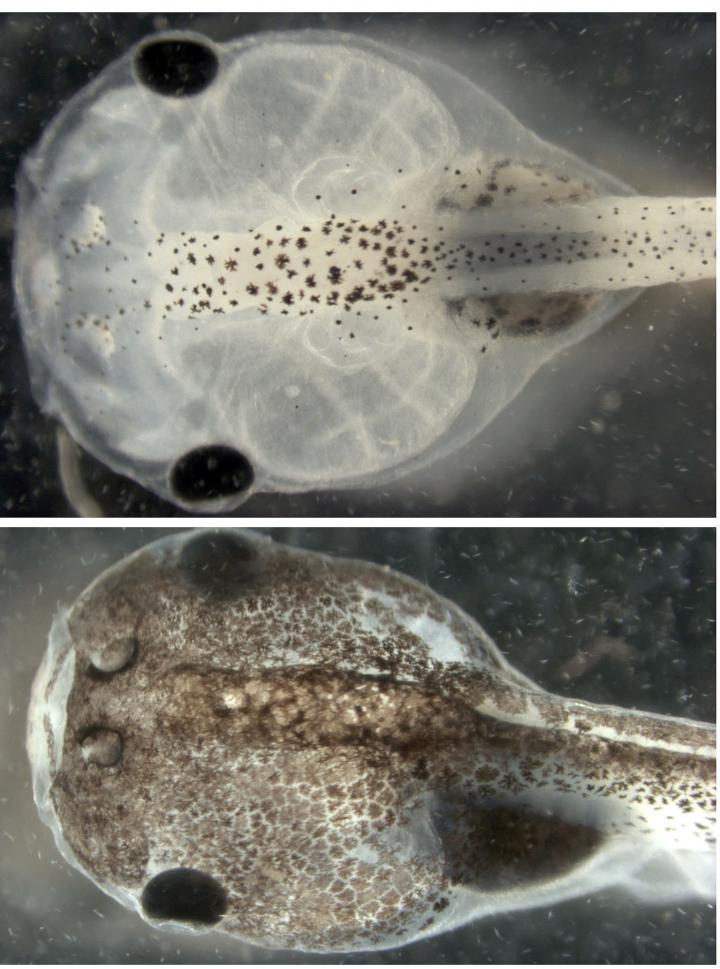 Tadpole Melanoma