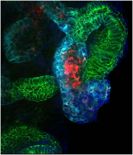 Kidney Organoids