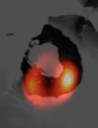 Lava Lake