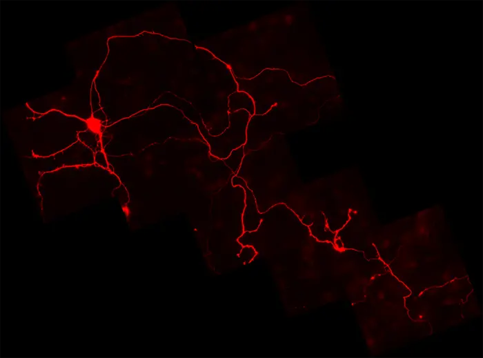 Aging Midbrain Neurons Face Energy Crisis Linked to Parkinson’s