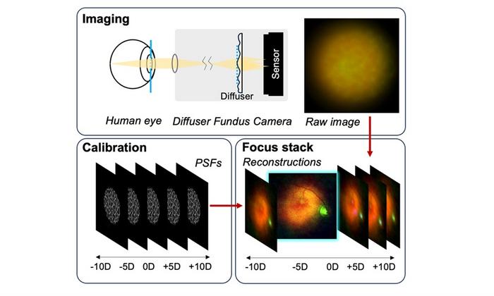 The imaging system uses a special diffuser that captures 3D light information from the retina during imaging.