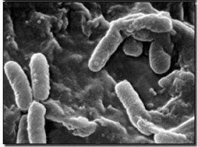 Microcapsules