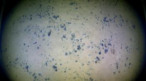 Polymetallic nodules on the seabed