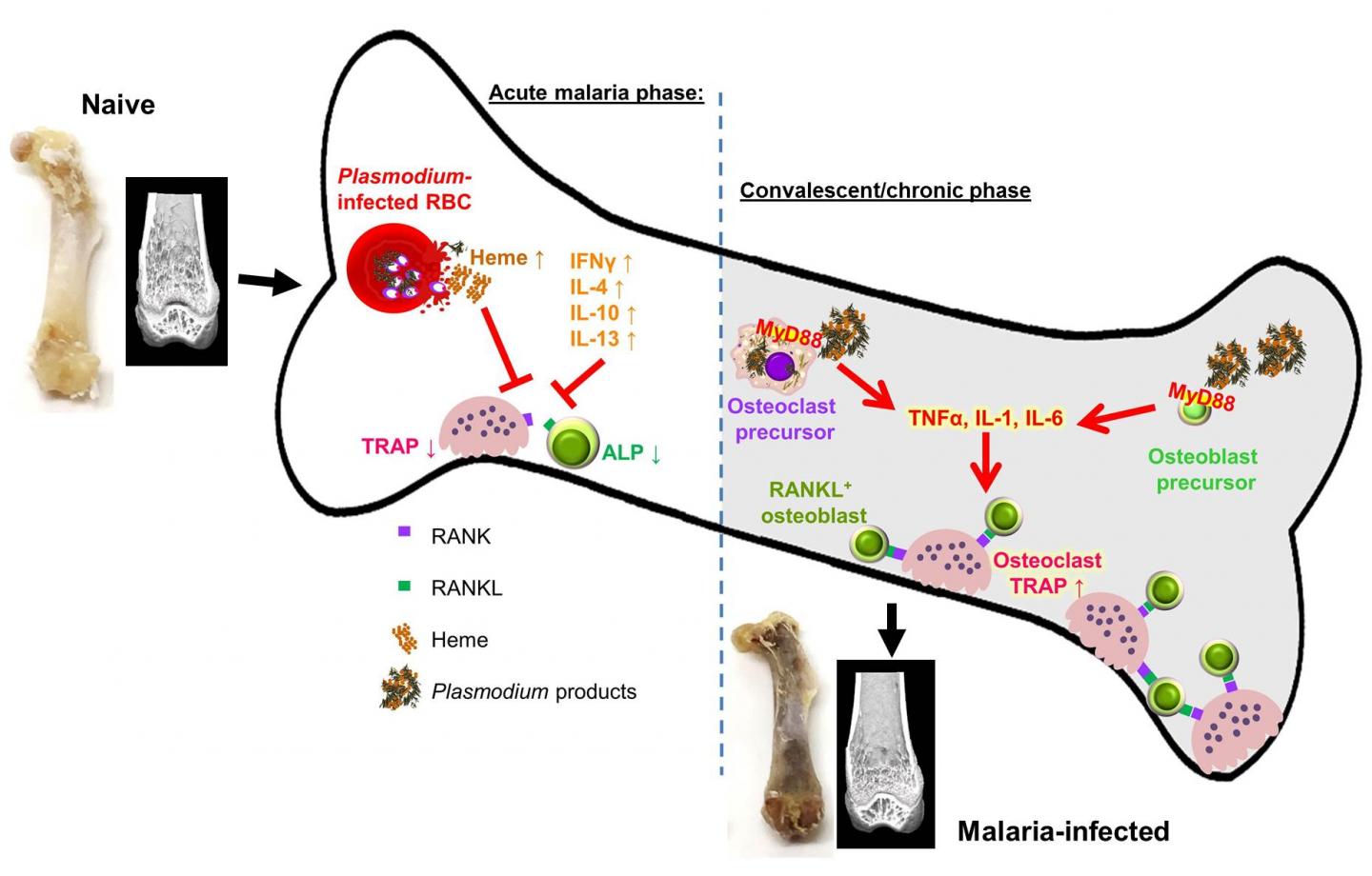 Chronic Bone Loss