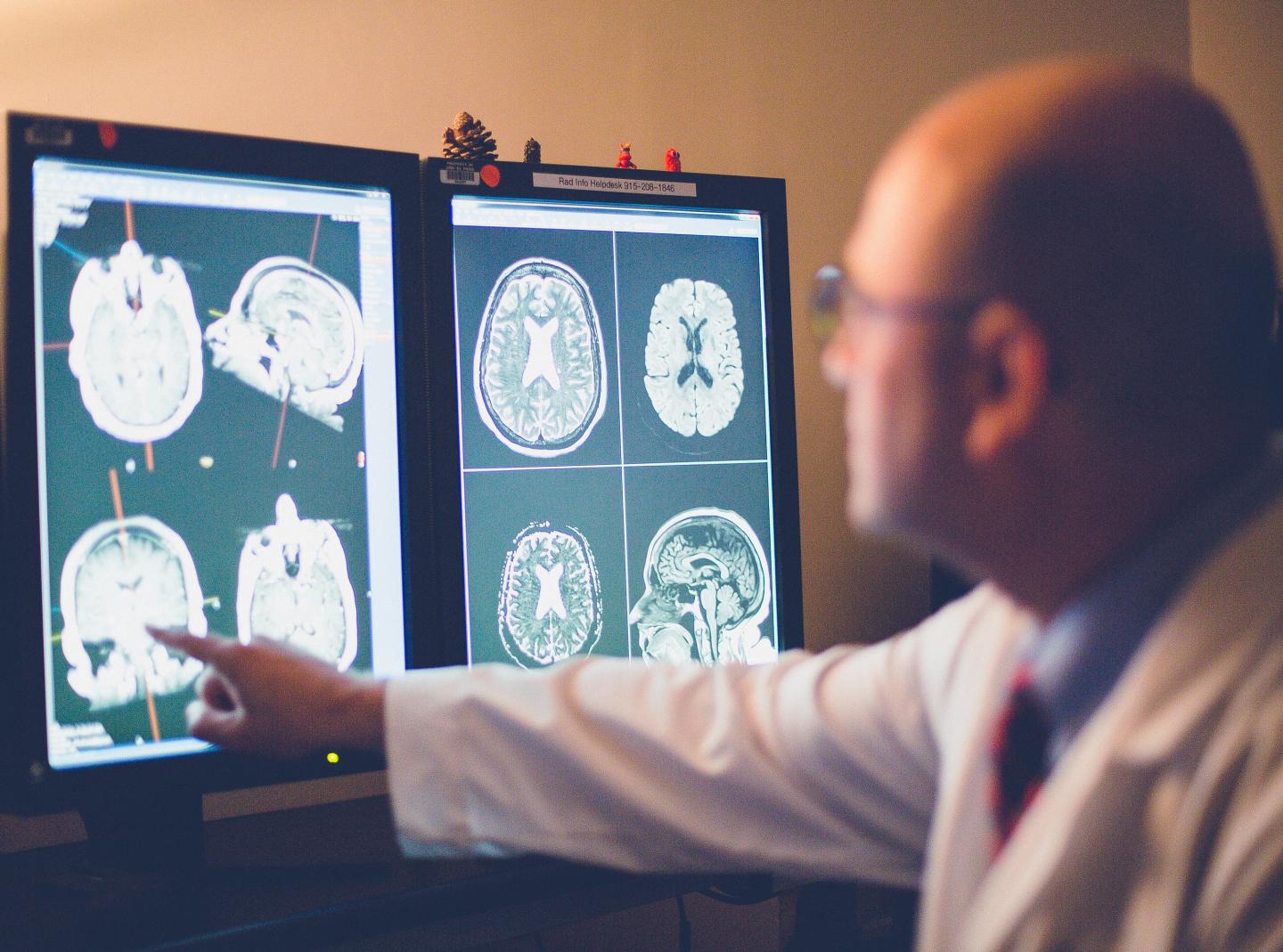 Study Finds Alzheimer's Manifests Differently in Hispanics