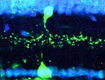 Object Motion and Amacrine Cells in Retina