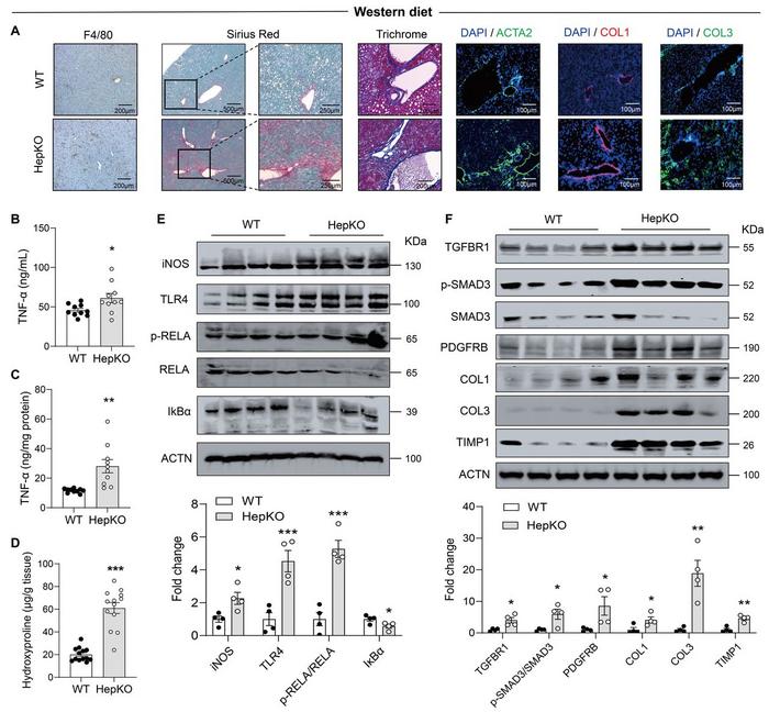 Atg14 HepKO mice have exacerbated hepatic inflammation and fibrosis on a Western diet.
