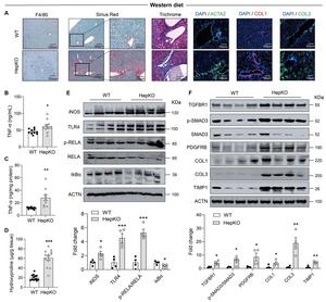 Atg14 HepKO mice have exacerbated hepatic inflammation and fibrosis on a Western diet.