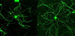 Neurons from Adult Mouse Spinal Cords