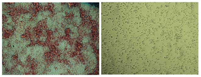 Targeting Fat to Treat Cancer