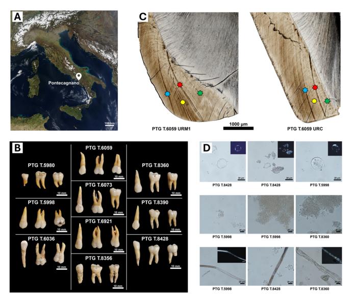 Health and lifestyle in the Iron Age Italian community of Pontecagnano (Campania, Italy, 7th-6th century BCE)