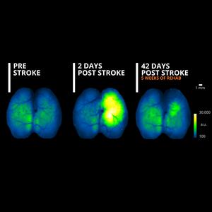 Combining non-invasive brain stimulation and robotic rehabilitation improves motor recovery in mouse stroke model