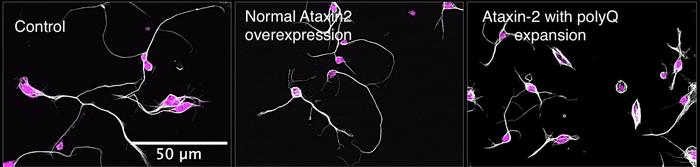 PolyQ-Expansion of Ataxin-2 Disrupts Microtubule Stability and Impairs Axon Outgrowth