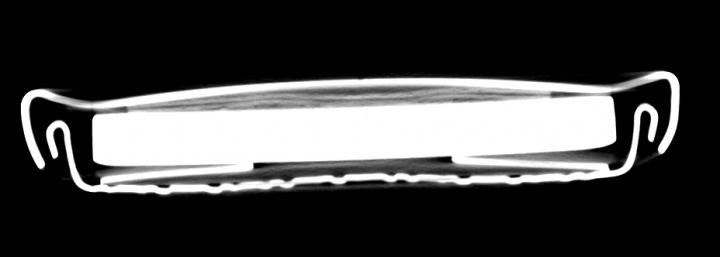 Coin Cell Battery Cross Section