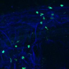 Visualization of Brain Immune Response