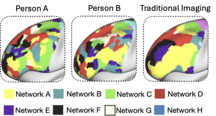 Prefrontal Cortex