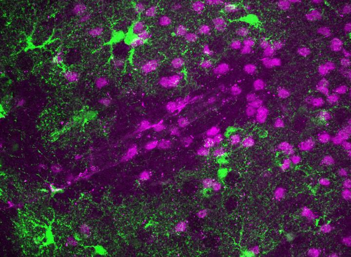 Leaky Blood-Brain Barrier