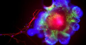 organoid