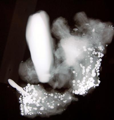 Bundle X-ray