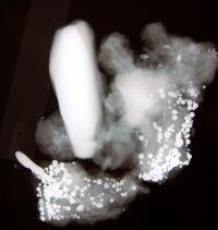Bundle X-ray