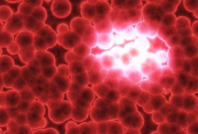 Cancer Metastasis