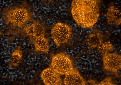 Spheres of Liver Cells on the Scaffold
