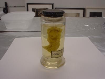 Intestine Sample