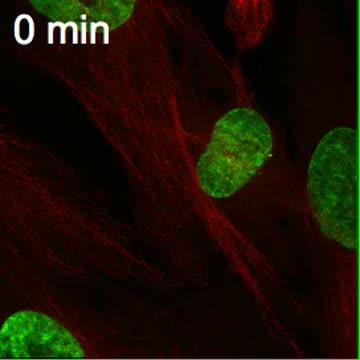 Normal Cell Division