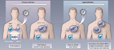 Strong Immune Response Can't Keep CMV Down (1 of 2)