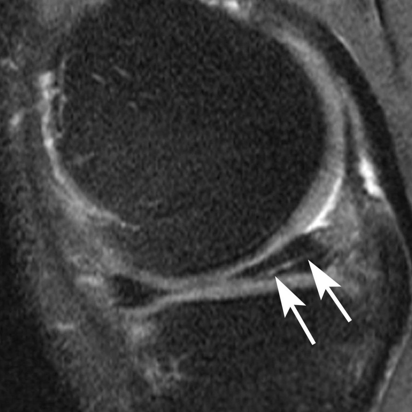 Bone Image