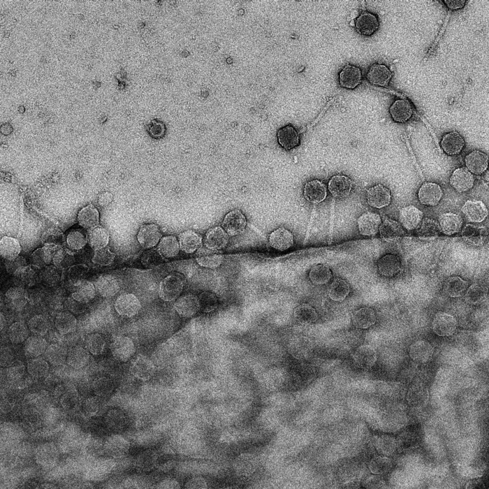 Cryo-electron microscopy image of bacteriophages attacking a cell.