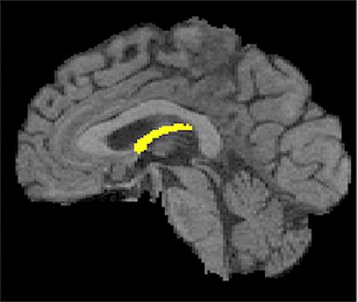 Brain