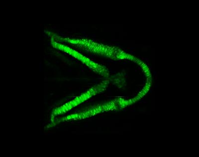 Developing Zebrafish Skeleton Showing Sox9