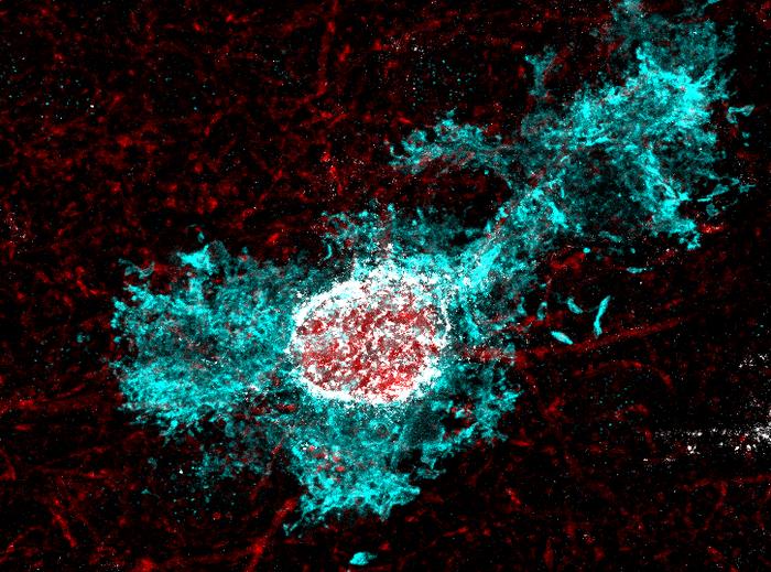 Astrocyte