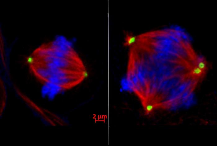 Study Finds Restoring Order to Dividing Cancer Cells May Prevent Metastasis
