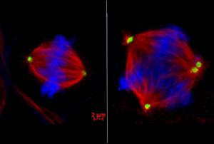 Study Finds Restoring Order to Dividing Cancer Cells May Prevent Metastasis