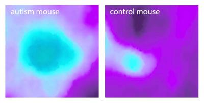 Autism Insular Cortex