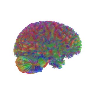 Era Two: A representative MRI tractography image of the second era of the human brain.