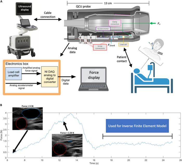 Data capture overview.