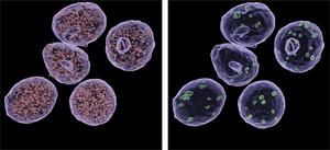 Mediator complex in pancreatic beta cells