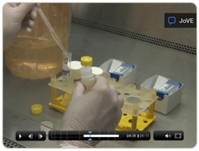 Xpert MTB/RIF Assay